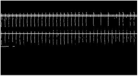 Fig. 11.